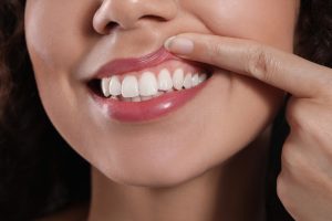 closeup of patient's gums