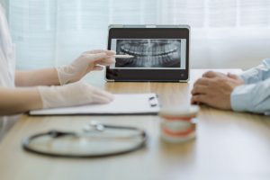 dental x-rays