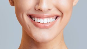 perfect smile